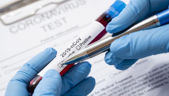 Yoluxanların sayı 2 mini keçdi