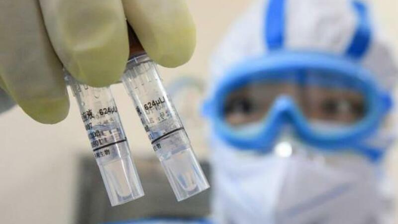 Koronavirusa REKORD SAYDA YOLUXMA: 13 milyondan çox insanın həyatı təhlükədədir