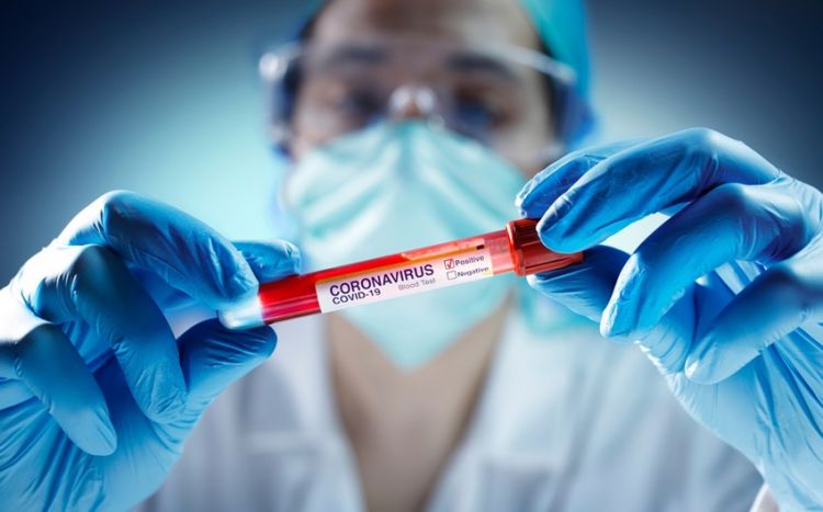 Azərbaycanda bu günə olan yoluxma sayı – COVID-19