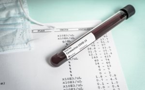 Bu ölkədə koronavirus testinin cavabı 3 dəqiqəyə hazır olacaq