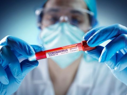 Azərbaycanda yoluxanların sayı artdı – COVID-19