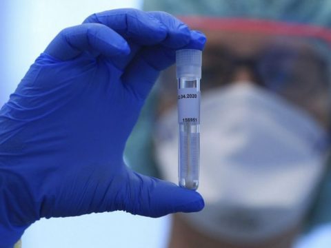 Azərbaycanda bu günə olan yoluxma sayı – COVID-19