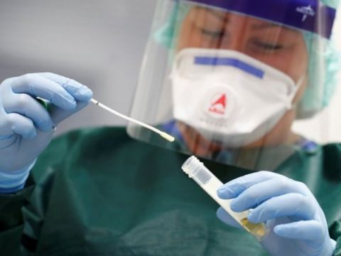 Azərbaycanda bu günə olan yoluxma sayı – COVID-19